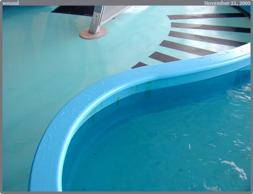 wound, taken 2005-11-21 || NIKON E950 | 7.5 | 1/24s @ f/2.6